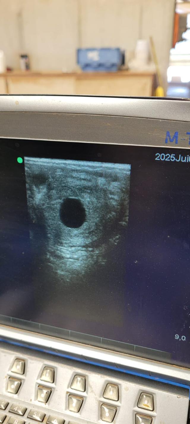 Échographie de suivi de gestation