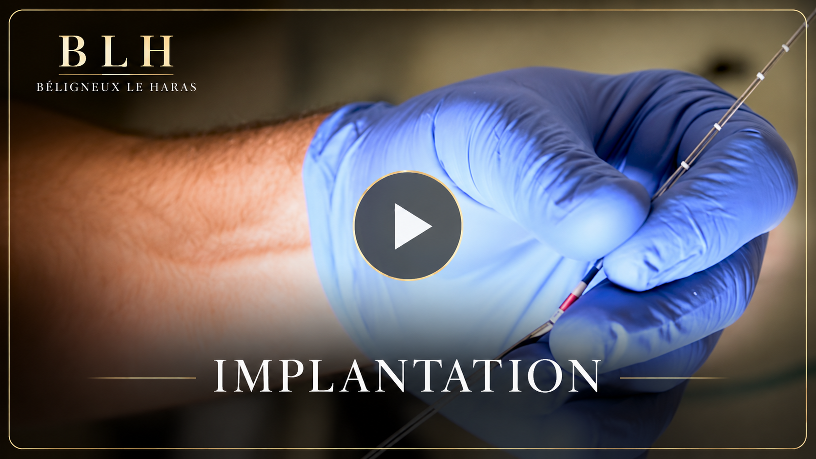 Vidéo implantation